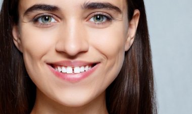 5 Faktor Penyebab Diastema, Kondisi Timbulnya Celah di Antara Gigi