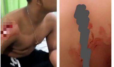 Viral Video Korban Begal Beredar di WAG, Polresta Pekanbaru Cek TKP dan RS, Hasilnya Nihil