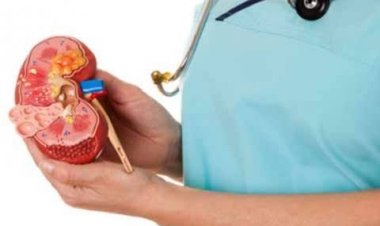 10 Ciri-ciri Gagal Ginjal yang Tidak Disadari, Salah Satunya Sulit Tidur