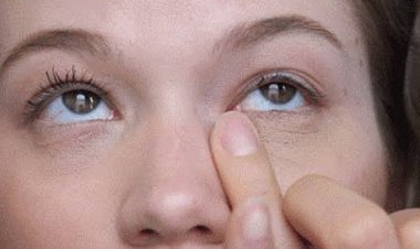 Tanda Kolesterol yang Muncul di Mata dan Kulit, Perhatikan Ini!