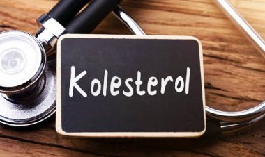 Ciri-ciri Kolesterol Tinggi Pada Wanita, Ini Kadar Normal dan Cara Mengatasinya