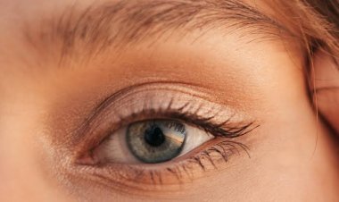 Tanda Kolesterol Tinggi Juga Bisa Muncul di Mata, Waspadai Ciri-cirinya