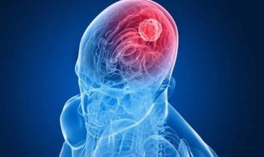 Ternyata Kebiasaan Ini Dapat Merusak Fungsi Otak, Bikin Lemot-Sulit Berpikir