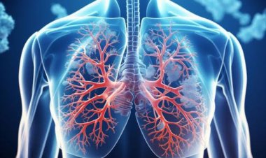 Ini 10 Cara Bersihkan Paru-paru Secara Alami