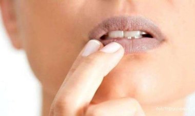 Berikut 6 Penyebab Bibir Berwarna Gelap, Waspada Masalah Kesehatan!