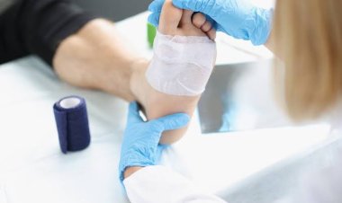 Ciri-ciri Diabetes Kering, Penyebab, dan Cara Merawat Lukanya