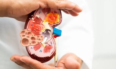 10 Gejala Awal Ginjal Bermasalah yang Kerap Tak Disadari