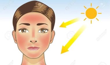 Sering Terpapar Sinar Matahari Picu Penuaan
