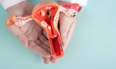 Waspada Kanker Serviks, Wanita Diimbau Manfaatkan IVA Test Gratis