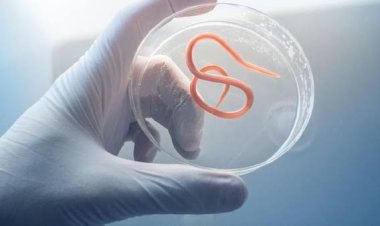 Pilu Balita di Sukabumi Meninggal, Ini Bahaya Cacingan yang Kerap Dianggap Sepele