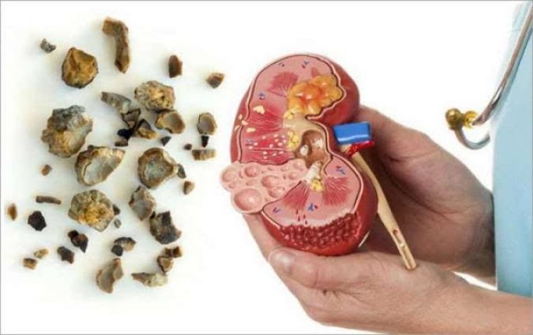 7 Tanda-Tanda Kerusakaan Ginjal yang Sering Tidak Disadari