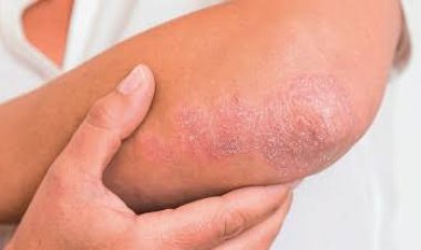 Ciri-Ciri Jantung Bermasalah Terlihat dari Kulit