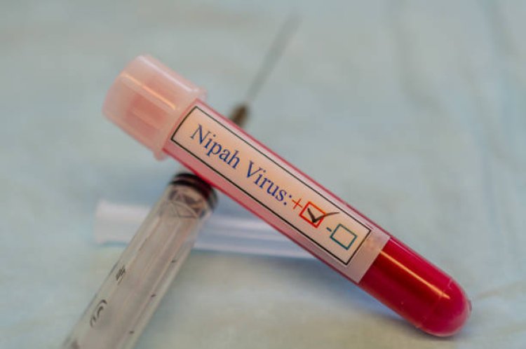 Virus Nipah Mematikan Muncul di India, Kemenkes Wanti-wanti Gejala dan Sumber Penularan