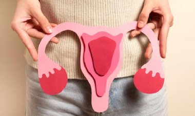 Gaya Hidup 'Kekinian' yang Tak Disadari Picu Kista Ovarium pada Usia Muda