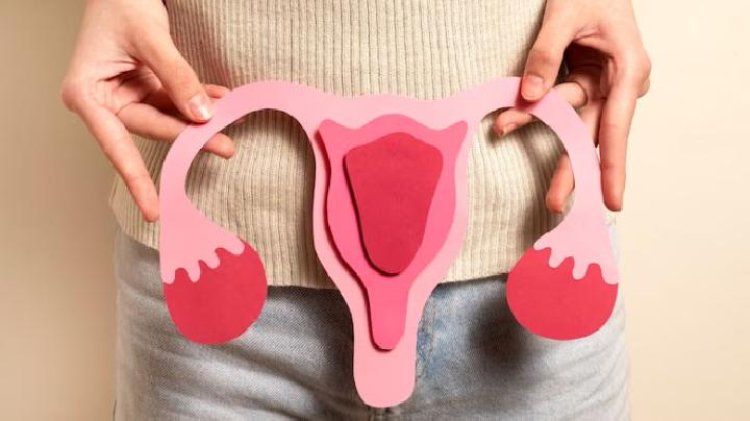 Gaya Hidup 'Kekinian' yang Tak Disadari Picu Kista Ovarium pada Usia Muda